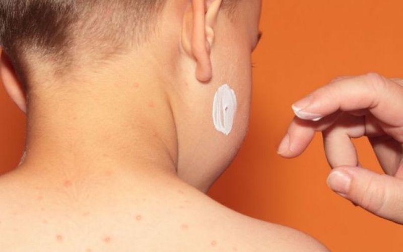 Focar de rujeolă în Buzescu