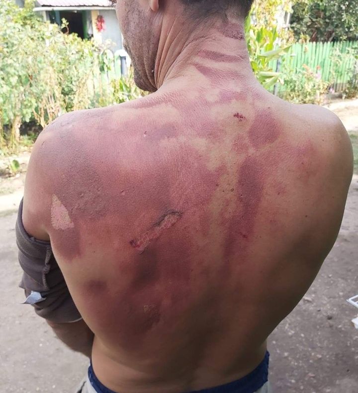 Tragedia unui tată-erou, care și-a scos fetița de 7 ani din flăcări