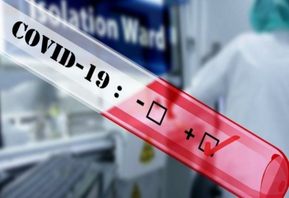 Bilanț COVID pentru ultimele 24 de ore:  1.109  cazuri noi și 36 de decese/ 465 dintre infectați sunt internați în secțiile ATI