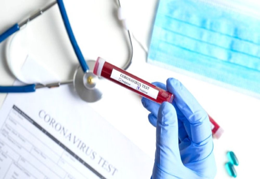 Cristi Barbu: "Guvernul României trimite un aparat PCR Real Time în Teleorman"